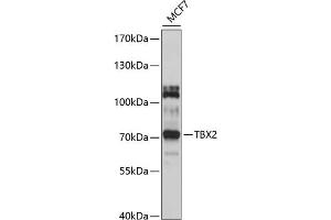 Western blot analysis of extracts of MCF-7 cells, using TBX2 antibody (ABIN6130916, ABIN6148906, ABIN6148907 and ABIN6214429) at 1:1000 dilution. (TBX2 antibody  (AA 300-470))