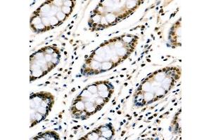 Immunohistochemistry (Paraffin-embedded Sections) (IHC (p)) image for anti-Transketolase (TKT) antibody (ABIN7075978)