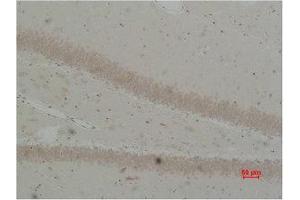 Immunohistochemistry (IHC) analysis of paraffin-embedded Rat Brain Tissue using BEST2 Polyclonal Antibody. (Bestrophin 2 antibody)