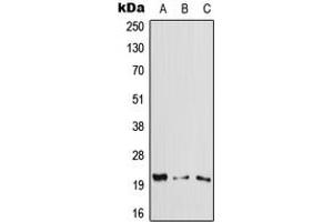 Western blot analysis of Cytoglobin expression in HeLa (A), Raw264. (CYGB antibody  (Center))
