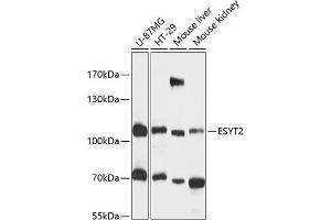 Western blot analysis of extracts of various cell lines, using ESYT2 antibody (ABIN6133009, ABIN6140463, ABIN6140464 and ABIN6216602) at 1:3000 dilution. (FAM62B antibody  (AA 630-760))