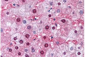 Human Liver (formalin-fixed, paraffin-embedded) stained with GSTM1 antibody ABIN214769 at 5 ug/ml followed by biotinylated goat anti-rabbit IgG secondary antibody ABIN481713, alkaline phosphatase-streptavidin and chromogen. (GSTM1 antibody  (AA 31-80))