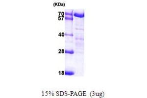 SDS-PAGE (SDS) image for Wolf-Hirschhorn Syndrome Candidate 2 (WHSC2) (AA 1-539) protein (His tag) (ABIN667859)