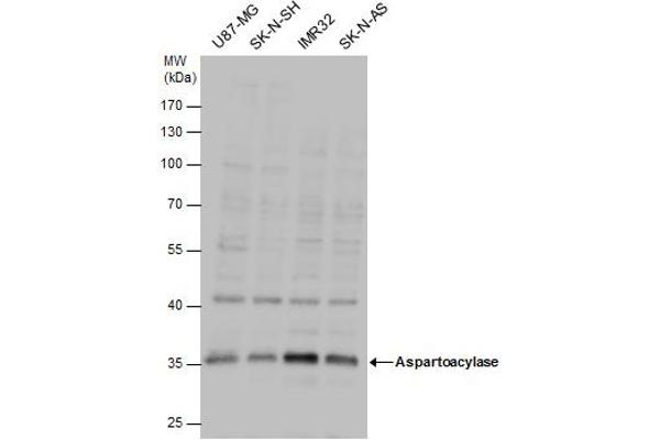 ASPA antibody