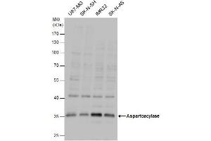 WB Image Aspartoacylase antibody detects Aspartoacylase protein by western blot analysis.