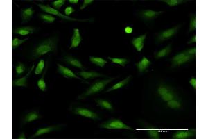 Immunofluorescence of monoclonal antibody to PRKCD on HeLa cell. (PKC delta antibody  (AA 577-676))