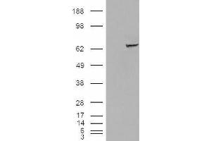 HEK293 overexpressing IGF2BP2 (ABIN5436057) and probed with ABIN238651 (mock transfection in first lane). (IGF2BP2 antibody  (C-Term))