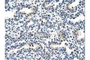 Image no. 1 for anti-Eukaryotic Translation Initiation Factor 2 Subunit 1 (EIF2S1) (C-Term) antibody (ABIN203305) (EIF2S1 antibody  (C-Term))