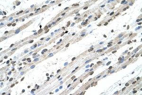 RCE1/FACE2 antibody  (AA 155-204)