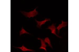 Immunofluorescence (fixed cells) (IF/ICC) image for anti-Ribosomal Protein S6 Kinase, 70kDa, Polypeptide 1 (RPS6KB1) (pThr229) antibody (ABIN6255636)