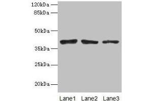 Western blot All lanes: ATP6AP2 antibody at 10 μg/mL Lane 1: Mouse eye tissue Lane 2: COLO205 whole cell lysate Lane 3: Hela whole cell lysate Secondary Goat polyclonal to rabbit IgG at 1/10000 dilution Predicted band size: 40, 36 kDa Observed band size: 40 kDa (ATP6AP2 antibody  (AA 17-350))