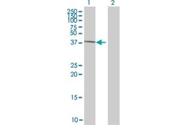 GTF2H2 antibody  (AA 1-395)