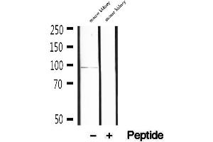 KIFC3 antibody  (C-Term)