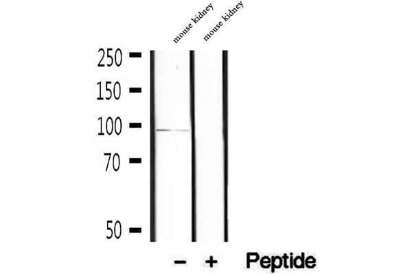 KIFC3 antibody  (C-Term)