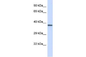 Host: Rabbit Target Name: GP1BA Sample Type: Jurkat Whole Cell lysates Antibody Dilution: 1. (CD42b antibody  (Middle Region))