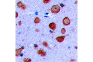 Immunohistochemical analysis of Kir6. (KCNJ11 antibody  (Center))