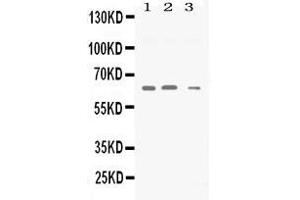 Western blot analysis of Synapsin II expression in rat brain extract ( Lane 1), mouse brain extract ( Lane 2) and U87 whole cell lysates ( Lane 3). (SYN2 antibody  (AA 497-582))