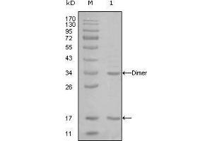 Western blot analysis using EP300 mouse mAb against truncated EP300-His recombinant protein (1). (p300 antibody)