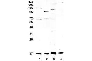 Western blot testing of 1) rat brain, 2) rat lung, 3) rat RH35 and 4) mouse lung lysate with Il1f10 antibody at 0.