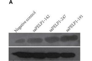 PELP1 activation promoted proliferation, colony formation, migration of GES-1 in vitro. (PELP1 antibody)