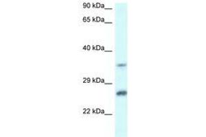 Image no. 1 for anti-Carbonyl Reductase 4 (CBR4) (AA 156-205) antibody (ABIN6747447) (CBR4 antibody  (AA 156-205))