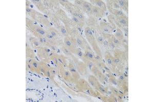 Immunohistochemistry of paraffin-embedded human liver using PTTG1 antibody (ABIN5974823) at dilution of 1/100 (40x lens). (PTTG1 antibody)