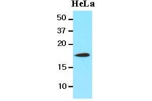 Western Blotting (WB) image for anti-Cofilin 1 (CFL1) (AA 1-166), (N-Term) antibody (ABIN336102) (Cofilin antibody  (N-Term))