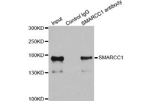 Immunoprecipitation analysis of 200ug extracts of 293T cells using 1ug SMARCC1 antibody. (SMARCC1 antibody)