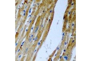 Immunohistochemical analysis of Malcavernin staining in rat heart formalin fixed paraffin embedded tissue section.