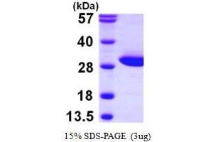 SDS-PAGE (SDS) image for Fumarylacetoacetate Hydrolase Domain Containing 1 (FAHD1) (AA 1-224) protein (His tag) (ABIN667344) (FAHD1 Protein (AA 1-224) (His tag))