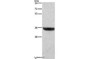 Western blot analysis of Human placenta tissue , using HSD17B1 Polyclonal Antibody at dilution of 1:700