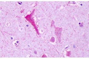 Anti-GPR137B antibody IHC staining of brain, neurons. (GPR137B antibody  (C-Term))