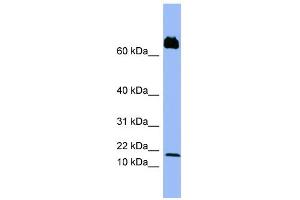 WB Suggested Anti-PF4V1 Antibody Titration:  0. (PF4V1 antibody  (Middle Region))