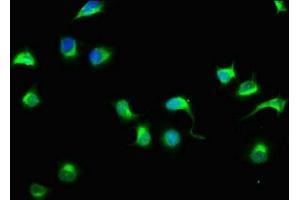 Immunofluorescence staining of A549 cells with ABIN7151029 at 1:33, counter-stained with DAPI. (HECTD3 antibody  (AA 682-785))