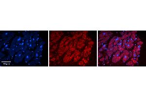 Rabbit Anti-ADAR Antibody   Formalin Fixed Paraffin Embedded Tissue: Human heart Tissue Observed Staining: Cytoplasmic Primary Antibody Concentration: N/A Other Working Concentrations: 1:600 Secondary Antibody: Donkey anti-Rabbit-Cy3 Secondary Antibody Concentration: 1:200 Magnification: 20X Exposure Time: 0. (ADAR antibody  (N-Term))