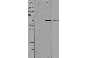 Western blot analysis of extracts from K562 using PARP2 antibody. (PARP2 antibody  (Internal Region))