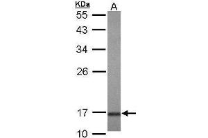 WB Image Sample (30 ug of whole cell lysate) A: Hela 10% SDS PAGE antibody diluted at 1:1000 (UBE2A antibody)