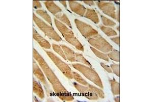 ISLR Antibody (C-term) (ABIN651071 and ABIN2840058) IHC analysis in formalin fixed and paraffin embedded skeletal muscle followed by peroxidase conjugation of the secondary antibody and DAB staining. (ISLR antibody  (C-Term))