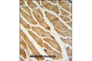 ISLR Antibody (C-term) (ABIN651071 and ABIN2840058) IHC analysis in formalin fixed and paraffin embedded skeletal muscle followed by peroxidase conjugation of the secondary antibody and DAB staining. (ISLR antibody  (C-Term))