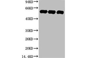 Western blot analysis of 1) Hela, 2) Rat BrianTissue, 3) Mouse Brain Tissue, diluted at 1:5000. (TUBA1A antibody)