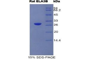 SDS-PAGE (SDS) image for Elastase 3B, Pancreatic (ELA3B) (AA 28-269) protein (His tag) (ABIN1525414) (Elastase 3B Protein (AA 28-269) (His tag))