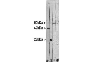 View of mixed neuron/glial cultures stained with CPCA-Vim (green) and ’s rabbit antibody to GFAP antibody (RPCA-GFAP, red).
