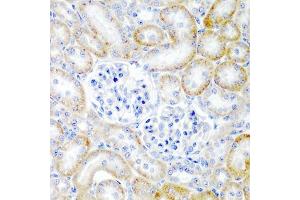 Immunohistochemistry of paraffin-embedded rat kidney using RLN2 antibody (ABIN6129627, ABIN6146976, ABIN6146977 and ABIN6222724) at dilution of 1:200 (40x lens). (Relaxin 2 antibody  (AA 25-185))