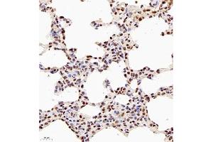 Immunohistochemistry of paraffin embedded rat lung using NSFL1C (ABIN7074865) at dilution of 1:700 (400x lens) (NSFL1C antibody)
