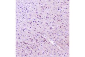 IHC analysis of RASAL1 using anti-RASAL1 antibody (ABIN6719367). (RASAL1 antibody  (AA 721-798))