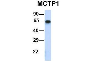 Host:  Rabbit  Target Name:  MCTP1  Sample Type:  Human Fetal Muscle  Antibody Dilution:  1. (MCTP1 antibody  (Middle Region))