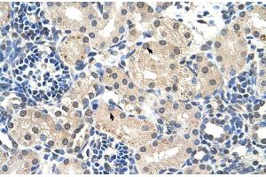 Human kidney (UBR7 antibody  (Middle Region))