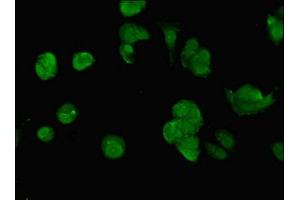 Immunofluorescent analysis of MCF-7 cells using ABIN7150297 at dilution of 1:100 and Alexa Fluor 488-congugated AffiniPure Goat Anti-Rabbit IgG(H+L) (SWI5 antibody  (AA 54-112))