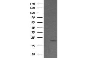 Image no. 2 for anti-NADH Dehydrogenase (Ubiquinone) 1 beta Subcomplex, 9, 22kDa (NDUFB9) (AA 3-179) antibody (ABIN1491359) (NDUFB9 antibody  (AA 3-179))