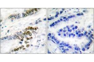 Immunohistochemistry (IHC) image for anti-Excision Repair Cross Complementing Polypeptide-1 (ERCC1) (AA 141-190) antibody (ABIN2889192) (ERCC1 antibody  (AA 141-190))